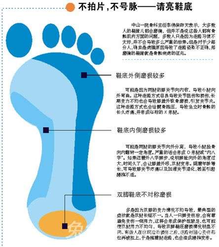 鞋底磨損太厲害？這是病呀得治